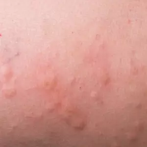 для чего используют гель для тела
