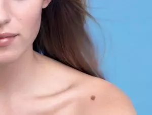 родинка на плече девушки
