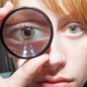 обследование глаза