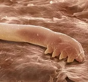 клещ демодекоза