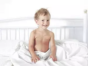 витилиго у мальчика