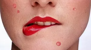 точки на лице девушки