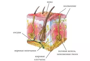 схема волосяного фоликула