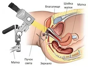 схема проведения кольпо- и вульвоскопии