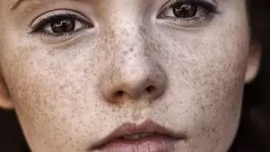 веснушки на лице девушки