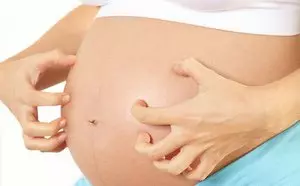 зуд живота беременной женщины