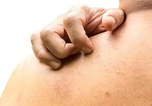 мужчина чешет спину