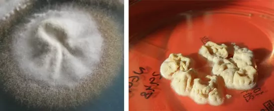 Паховая эпидермофития